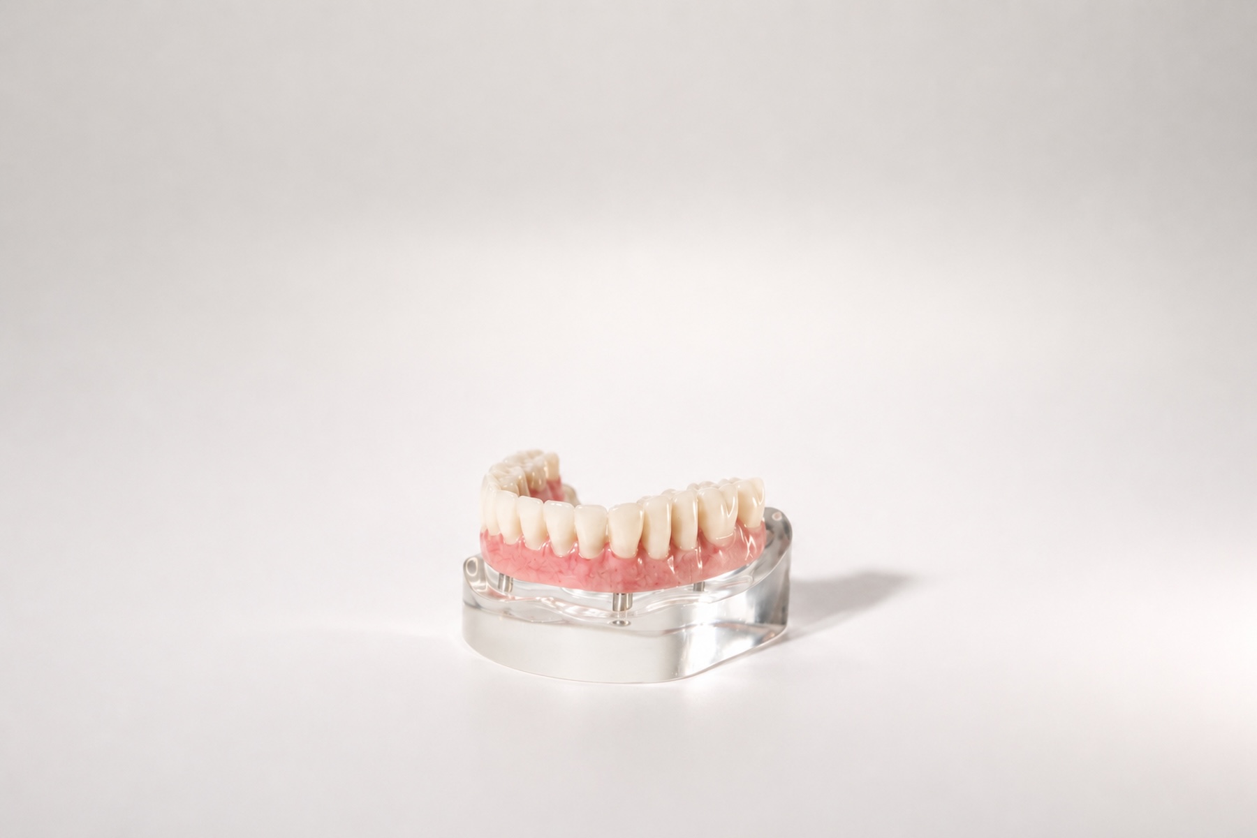 Woman getting a full mouth restoration