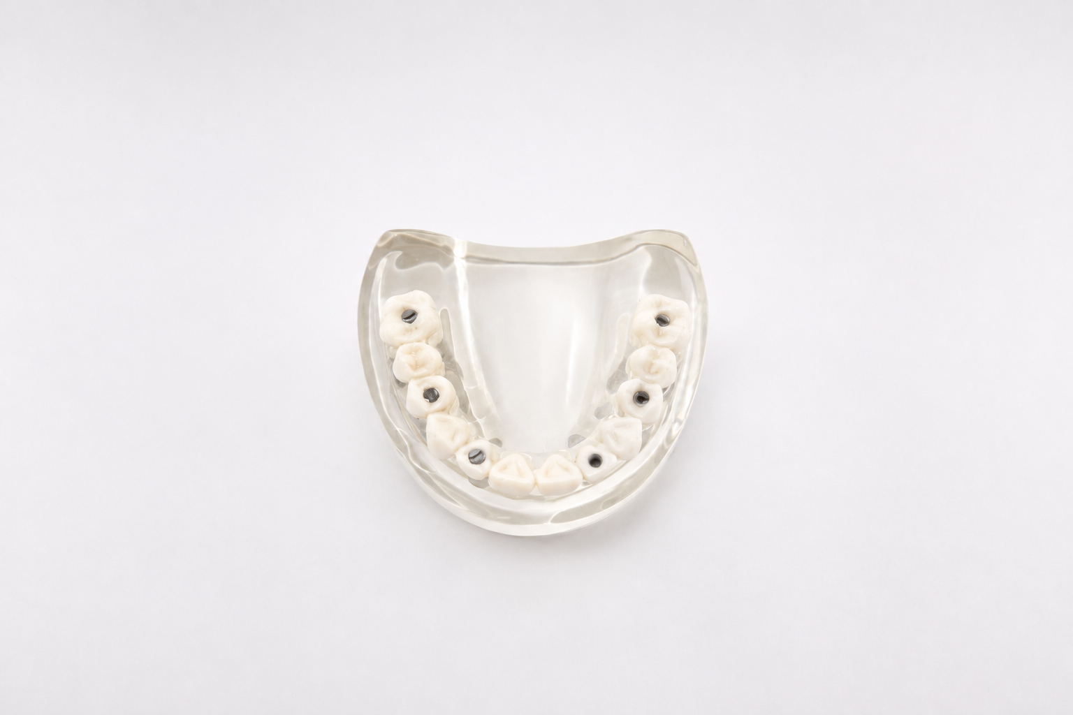 Diagram of dental implants in Tampa FL
