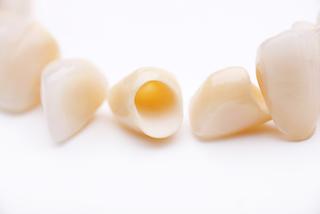 Close up of dental crowns at Carrolwood Village Dental in Tampa FL