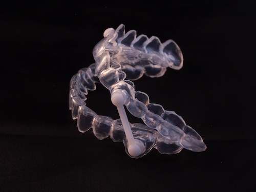 Custom oral appliance used for sleep apnea treatment to improve airflow during sleep in Carrollwood Village, FL