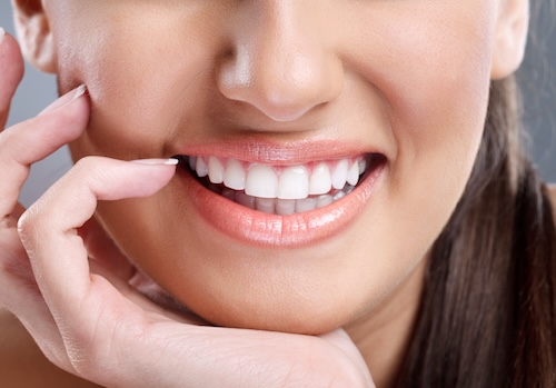 Close-up of bright, even smile after porcelain veneers treatment in Carrollwood Village, FL