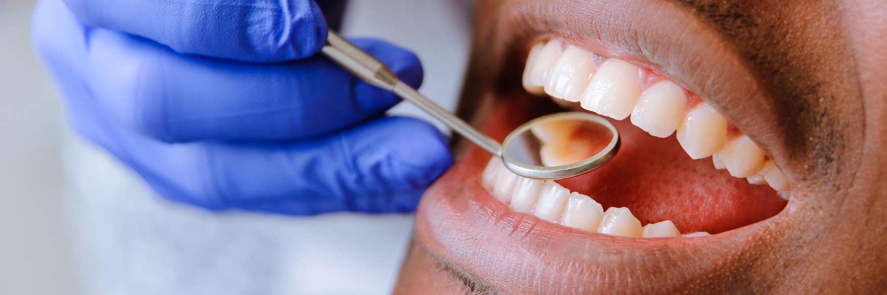 Man getting undergoing dental check up in Tampa FL