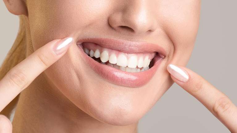 An image of a woman smiling after removing clear braces in Tampa, FL