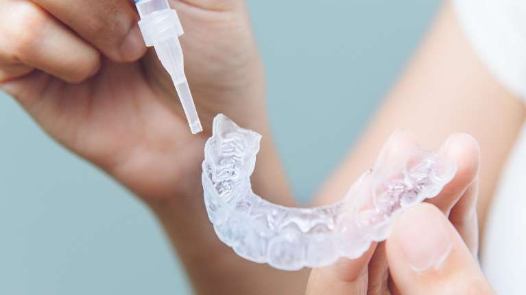 A hand holding clear braces in Tampa, FL