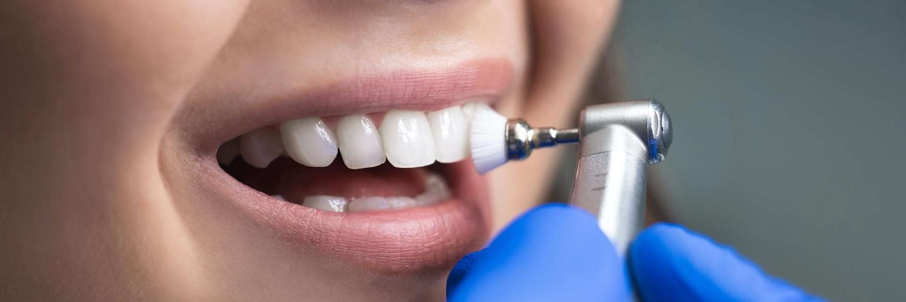 Lady undergoing Teeth Cleaning in Tampa, FL