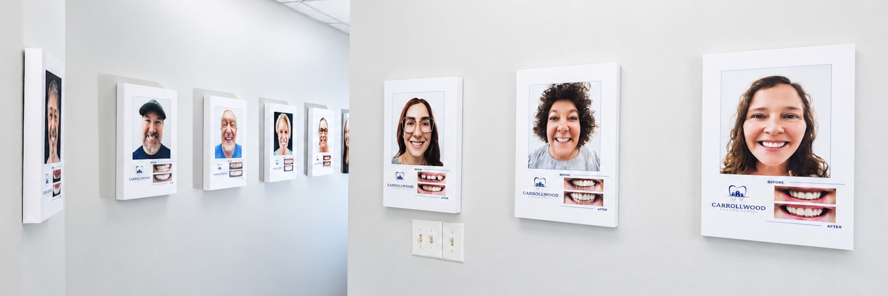 Dental patient smiling after cosmetic dentistry in Tampa