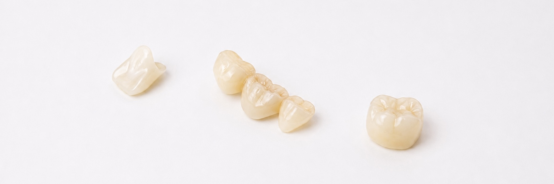 Crowns and Bridges | Dentist
