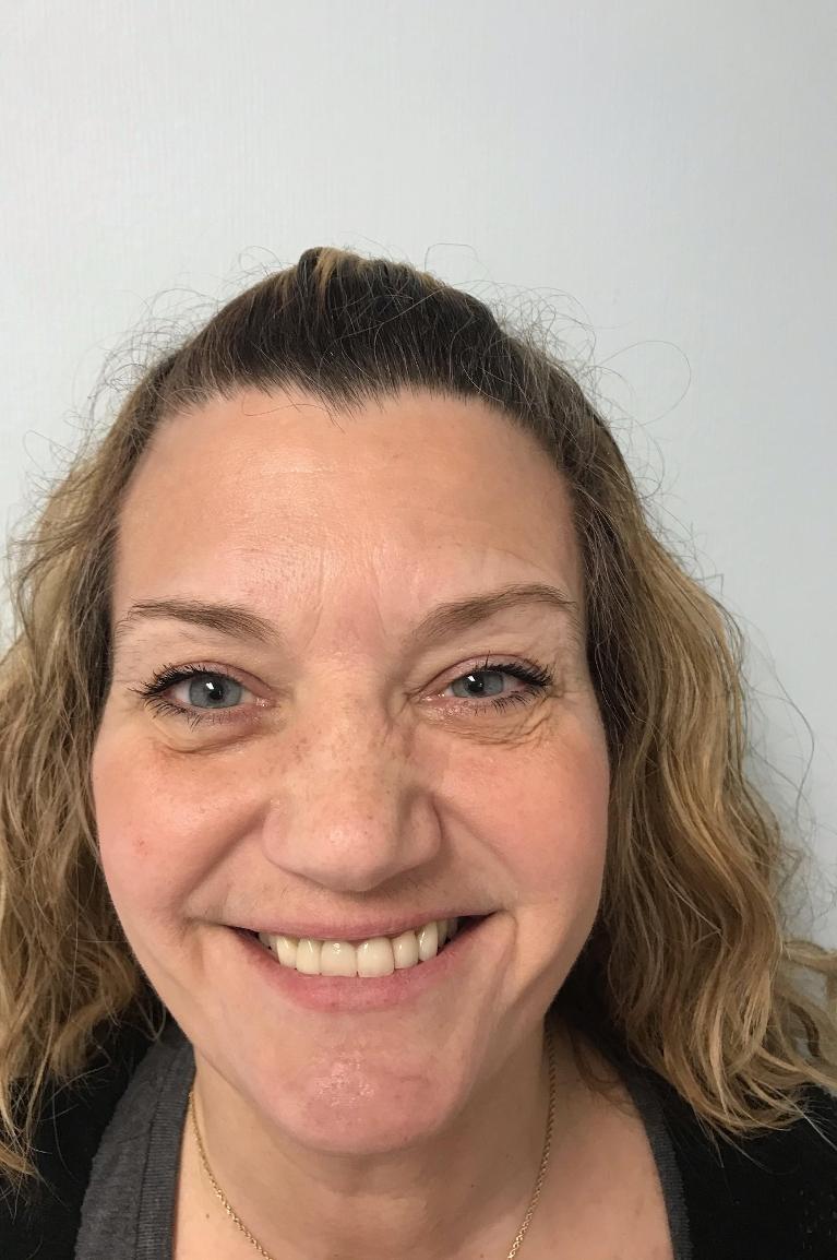 A smiling patient after a front tooth replacement