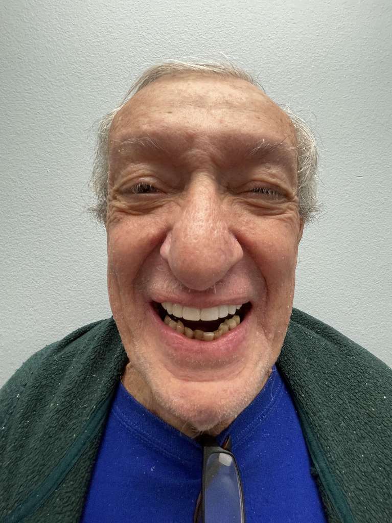 After - Portrait Layout of A new beautiful smile!