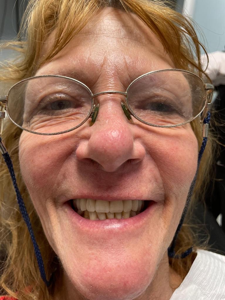 Carrollwood village dental patient after receiving new dentures